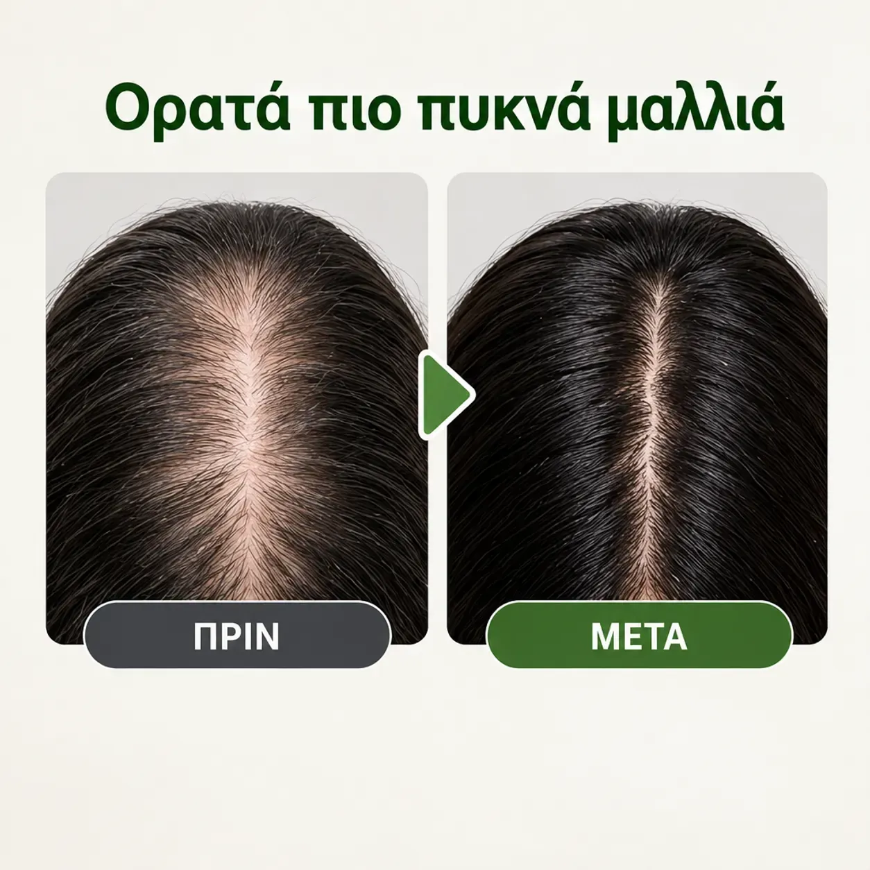 Έλαιο μαλλιών και κεφαλής με τζίντζερ, Disaar Hair Essential Oil, φροντίδα για τις ρίζες, 30 γρ φωτογραφία 3